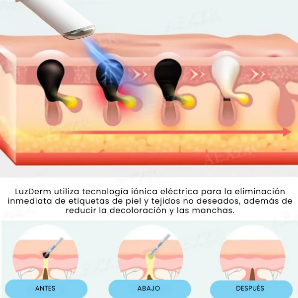 LuzDerm